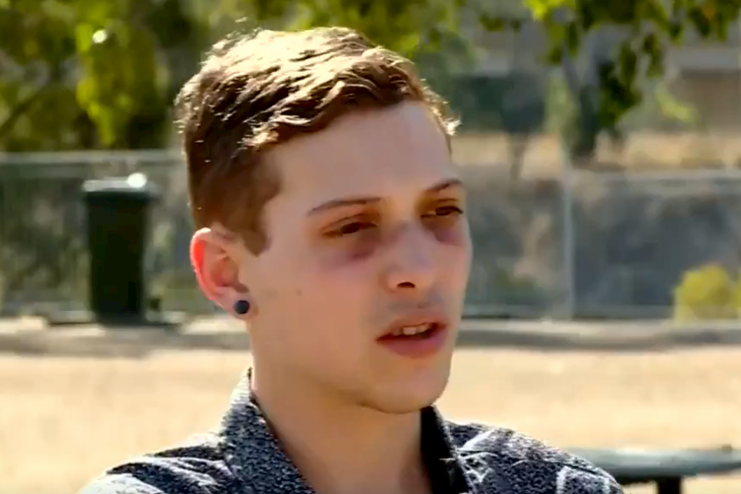 Prøve detaljeret Orator Australian gay man hunted down and beaten by "bloodthirsty" teenagers -  Metro Weekly