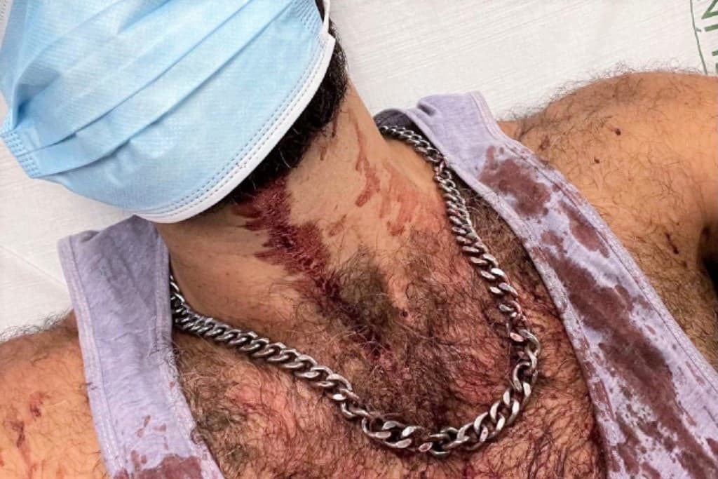 Gay man has jaw "destroyed" with hammer in brutal attack